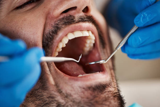 Best Urgent Dental Care  in Paincourtville, LA