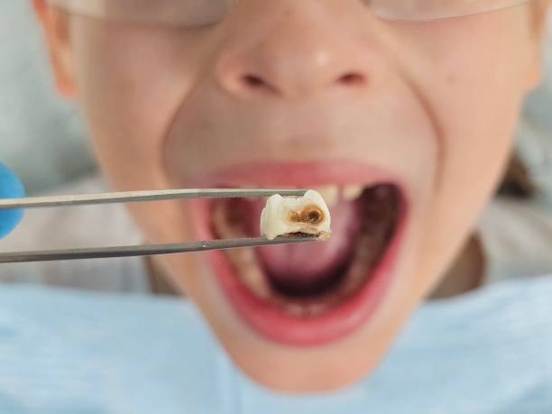 Best Dentist Open Late Near Me  in Paincourtville, LA