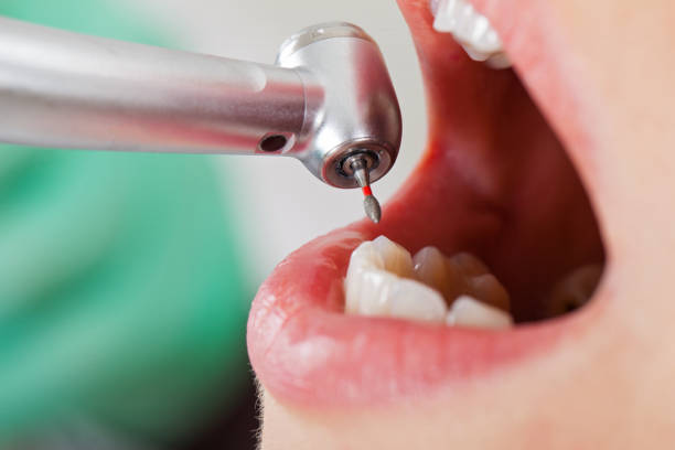 Emergency Dentist for Kids in LA